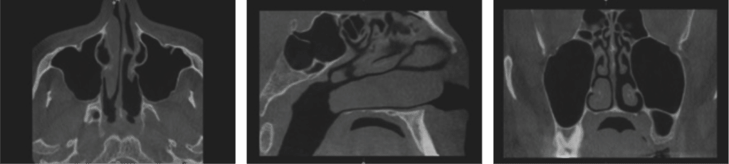 CBCT Bilder